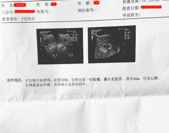 感谢广州南方医院生殖中心，挺负责的
